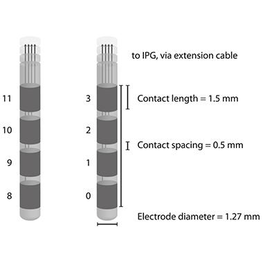 Electrode-DBS-3389