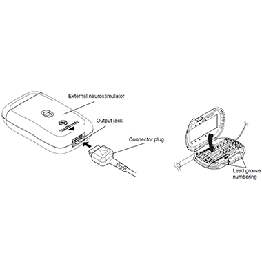 stimulat-externe-3